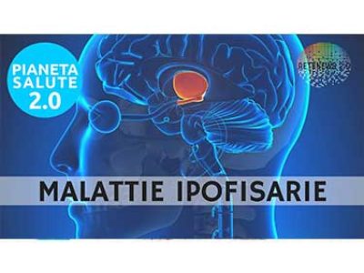 MALATTIE IPOFISARIE. PIANETA SALUTE 2.0 - 90a PUNTATA