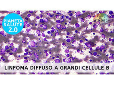 Linfoma diffuso a grandi cellule B. PIANETA SALUTE 2.0 puntata 224