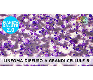 Linfoma Diffuso A Grandi Cellule B. PIANETA SALUTE 2.0 Puntata 224 ...