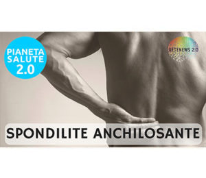 La Spondilite anchilosante. PIANETA SALUTE - 70 PUNTATA