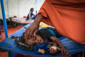 UNICEF/Somalia: i bambini gravemente malnutriti aumentano del 50%